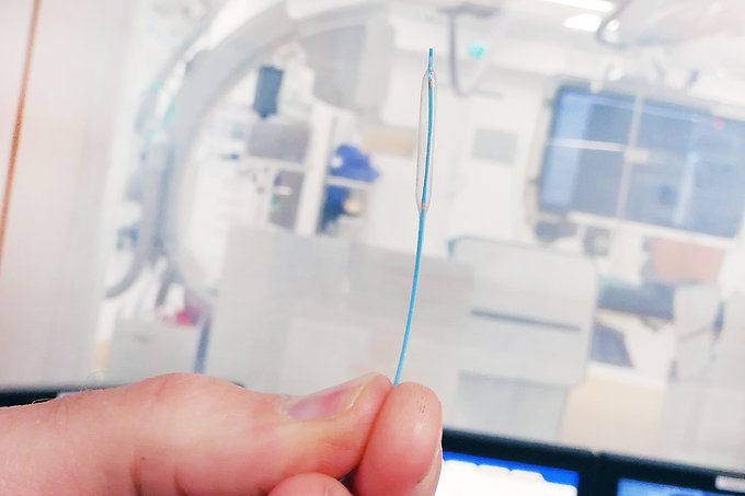 närbild på den lilla ballong som förs in i hjärtats kranskärl och utvidgas